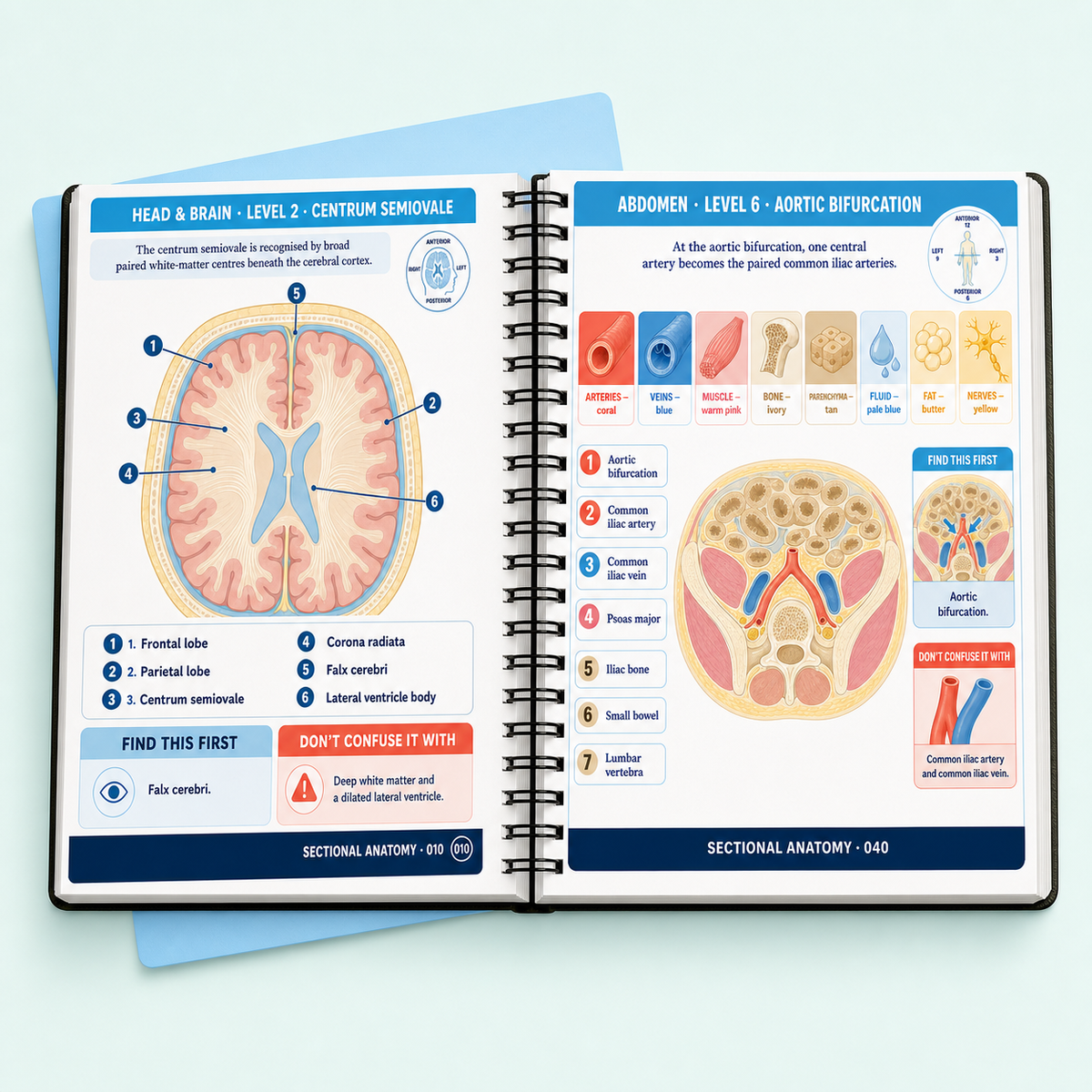 Sectional Anatomy & Advanced Modalities